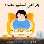 دوره نقاهت عمل اسلیو معده