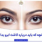 هرآنچه که باید درباره کاشت ابرو بدانیم - تصویر 1