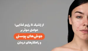 جوش‌های پوستی، دشمن زیبایی شما